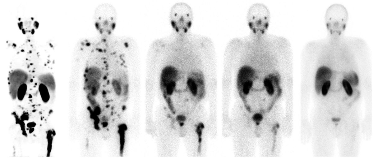 Teragnosis is the new hope against cancer |  Science