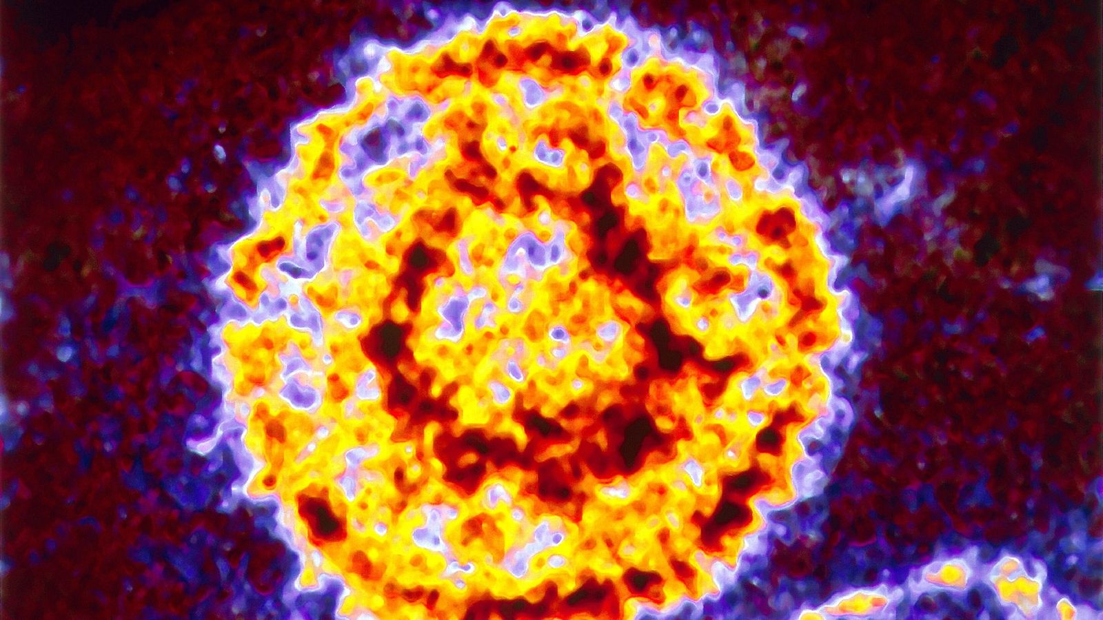Вирус Эпштейна-Барр фото вируса