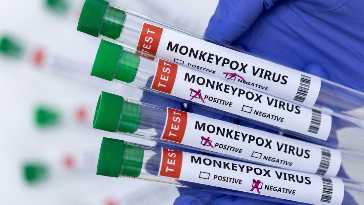 Monkeypox: ‘Don’t panic’