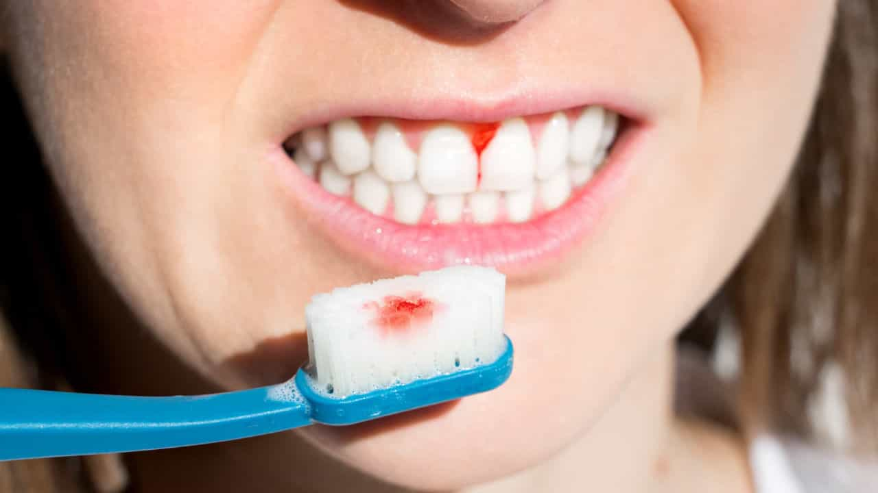 These people are more likely to get gum disease.

