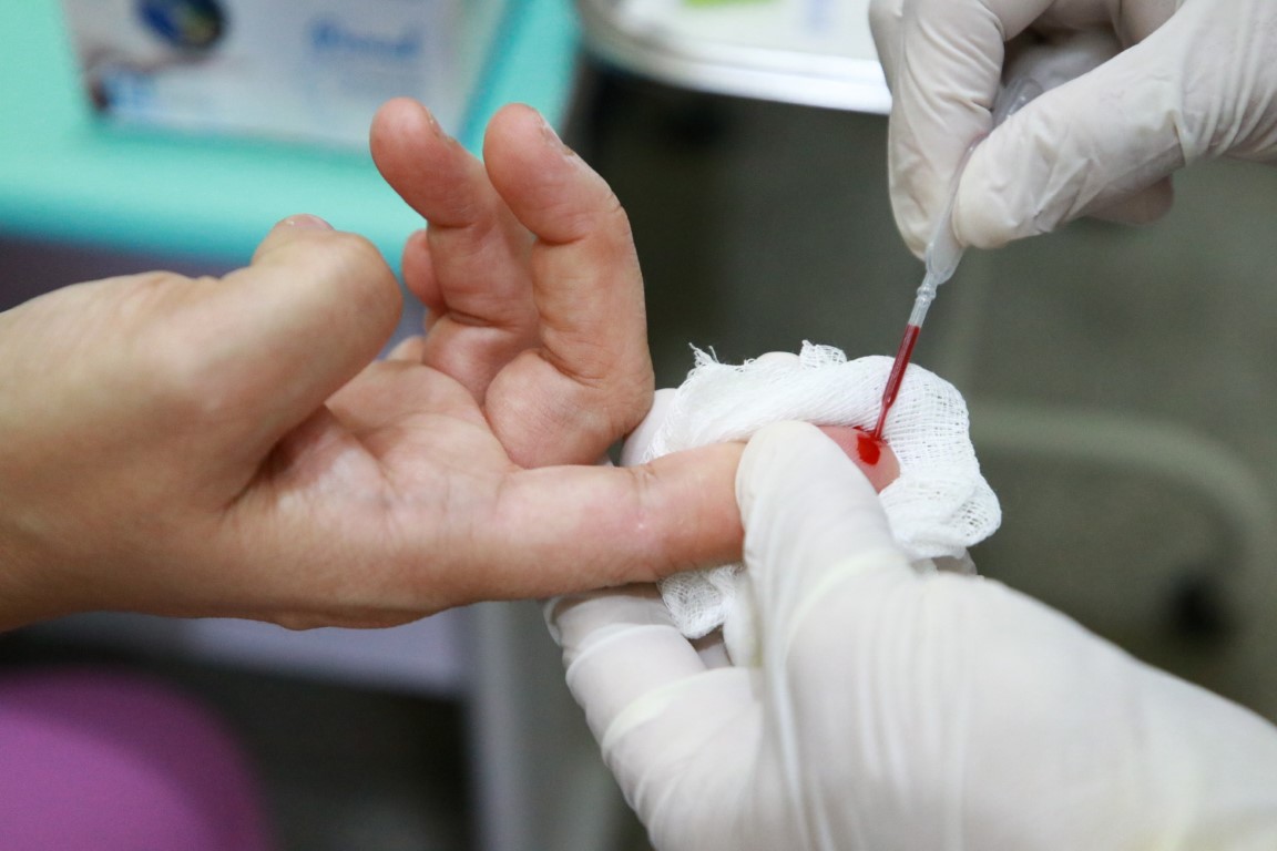 Red December: SPA and Policlínica José Lins intensify HIV / AIDS testing measures

